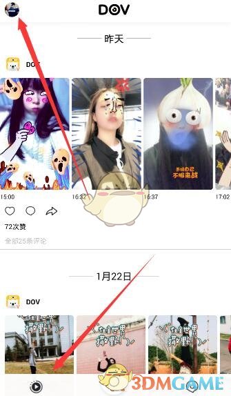 韩安冉老公去做医美了